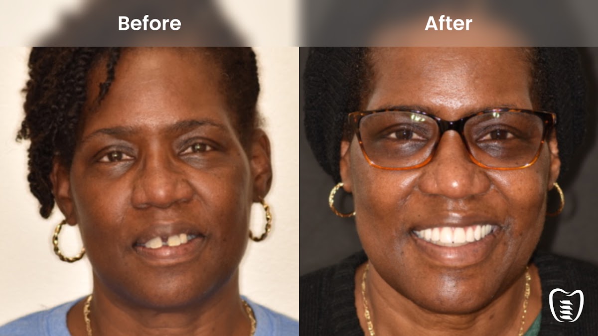 All on Implants Charleston photo 2