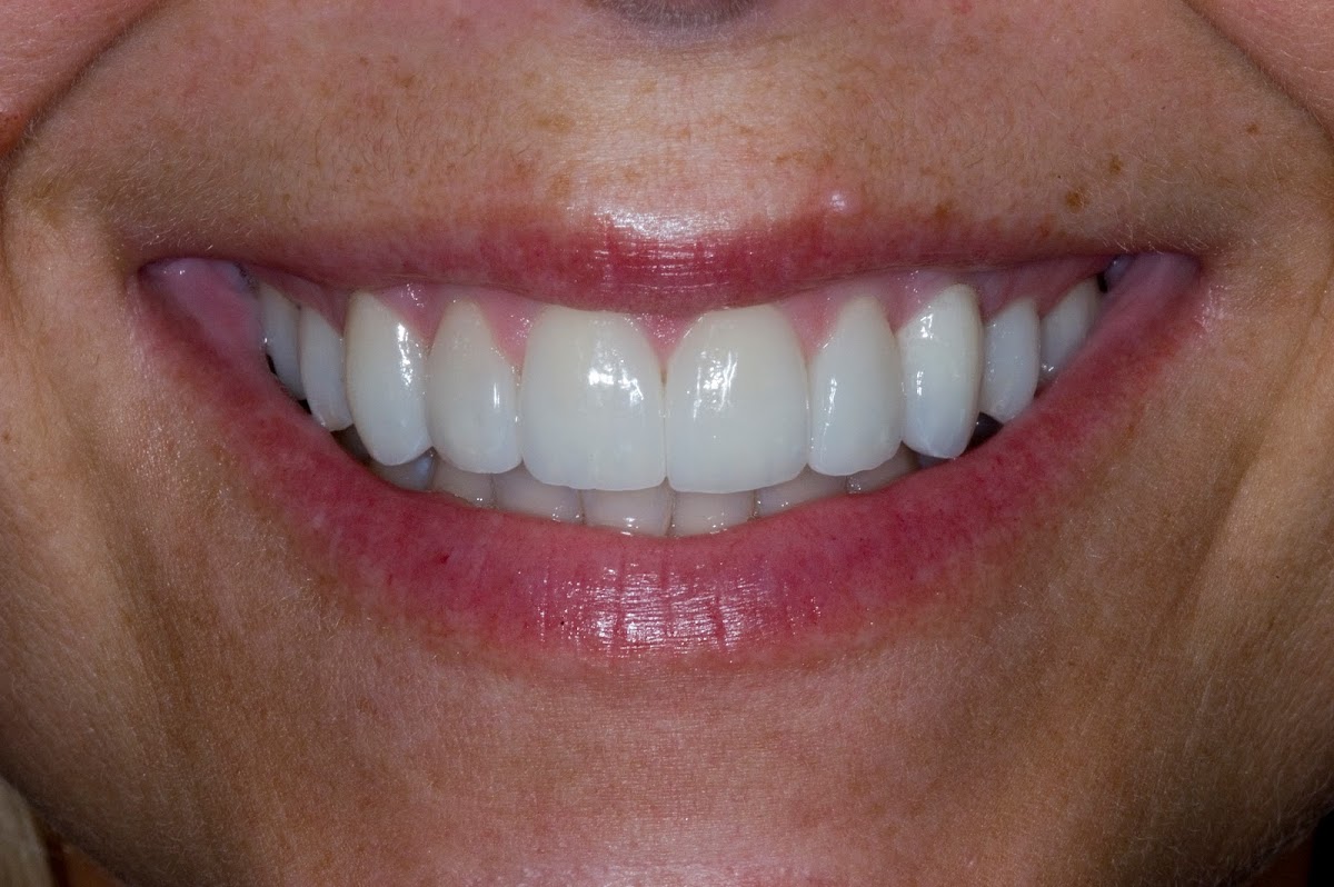 Route 66 Dental Implants photo 1