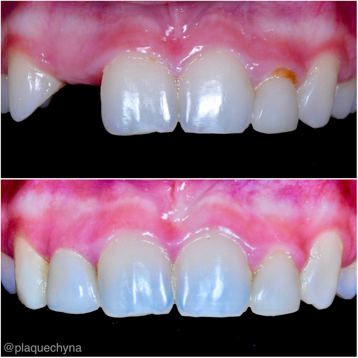 Route 66 Dental Implants photo 6