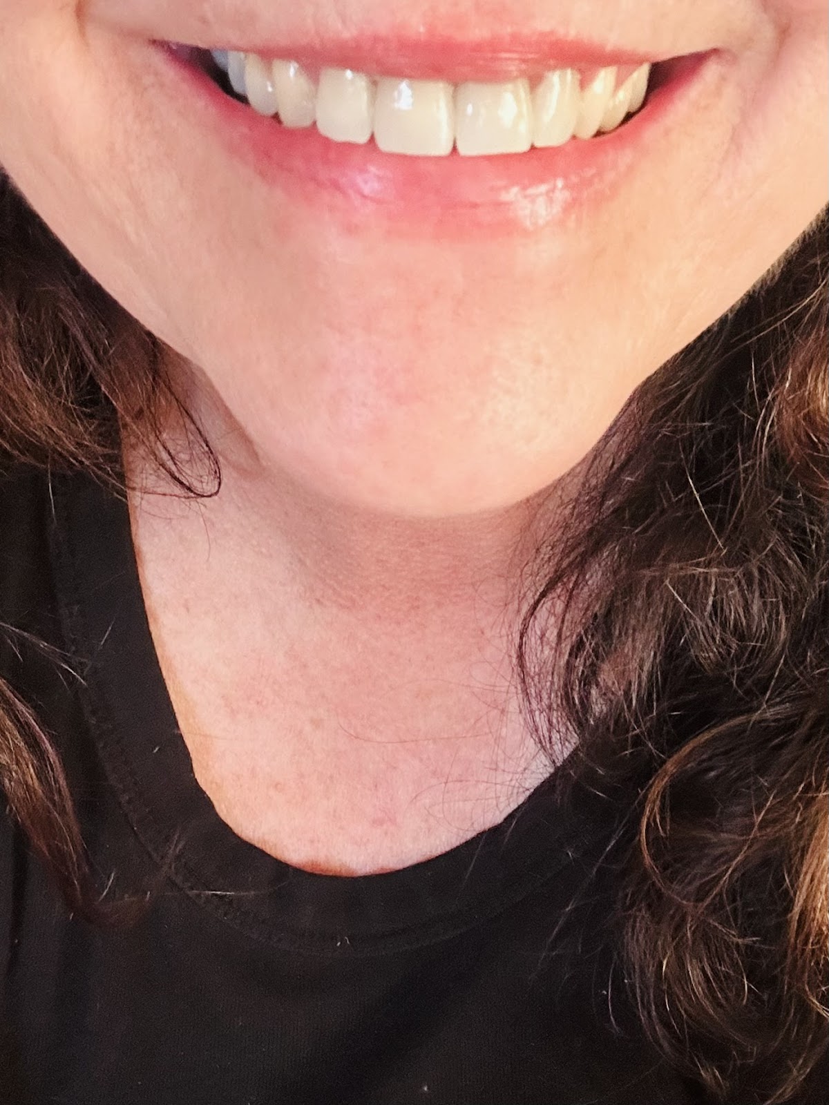 Holly Beach Dental Associates photo 2