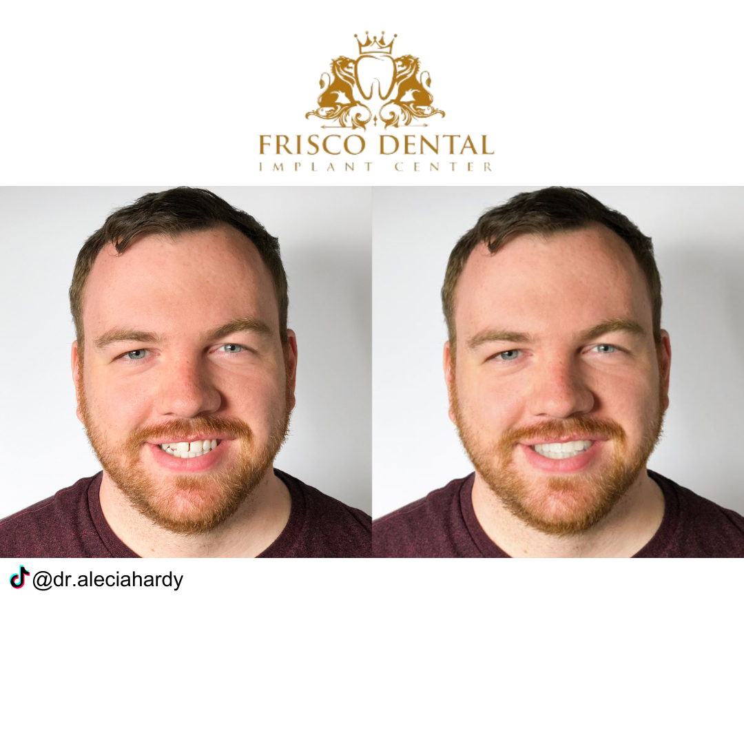 Frisco Dental Implant Center: Alecia Hardy, Dds photo 4