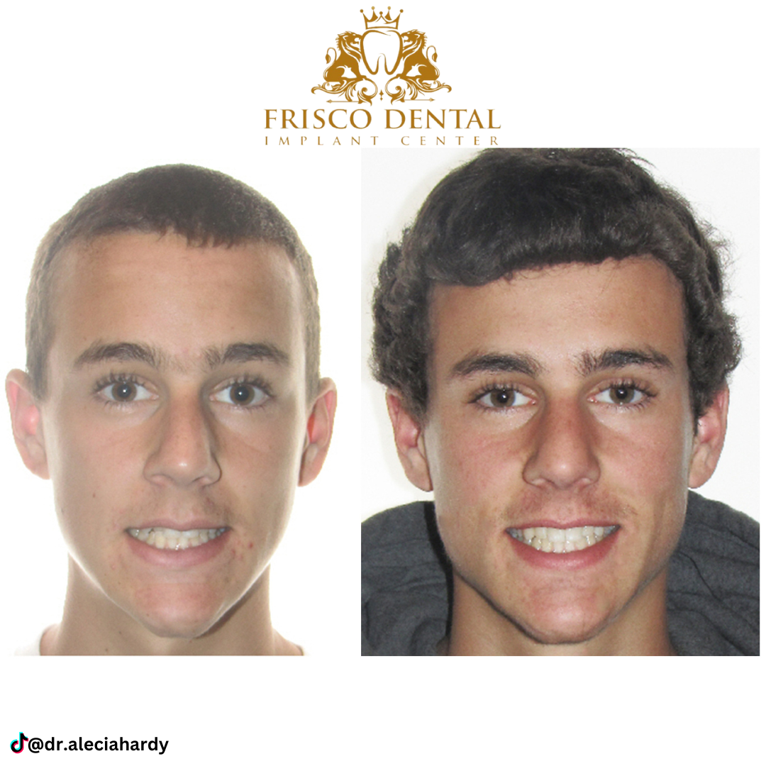 Frisco Dental Implant Center: Alecia Hardy, Dds photo 5