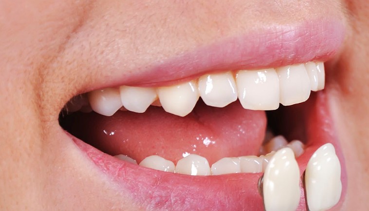 Orchard Meadows Family Dental & Denture Clinic photo 3