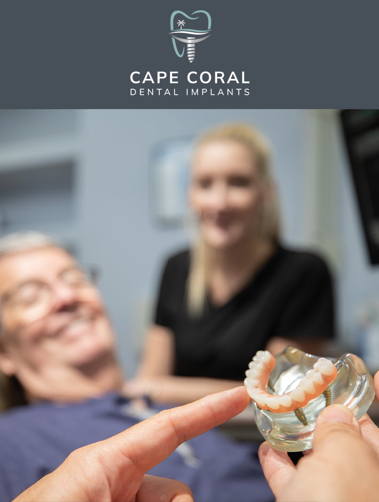 Cape Coral Dental Implants photo 5