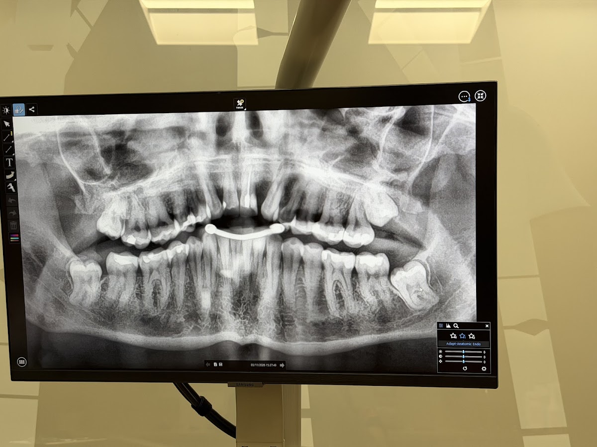 Aspen Dental - Atlanta photo 2