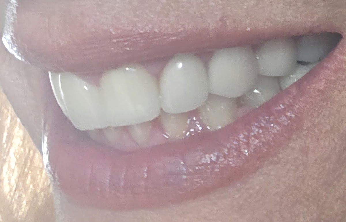 Serenity Dental, Lake Havasu City Dentist photo 5