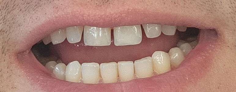 Alora Dentistry & Implant Center photo 6
