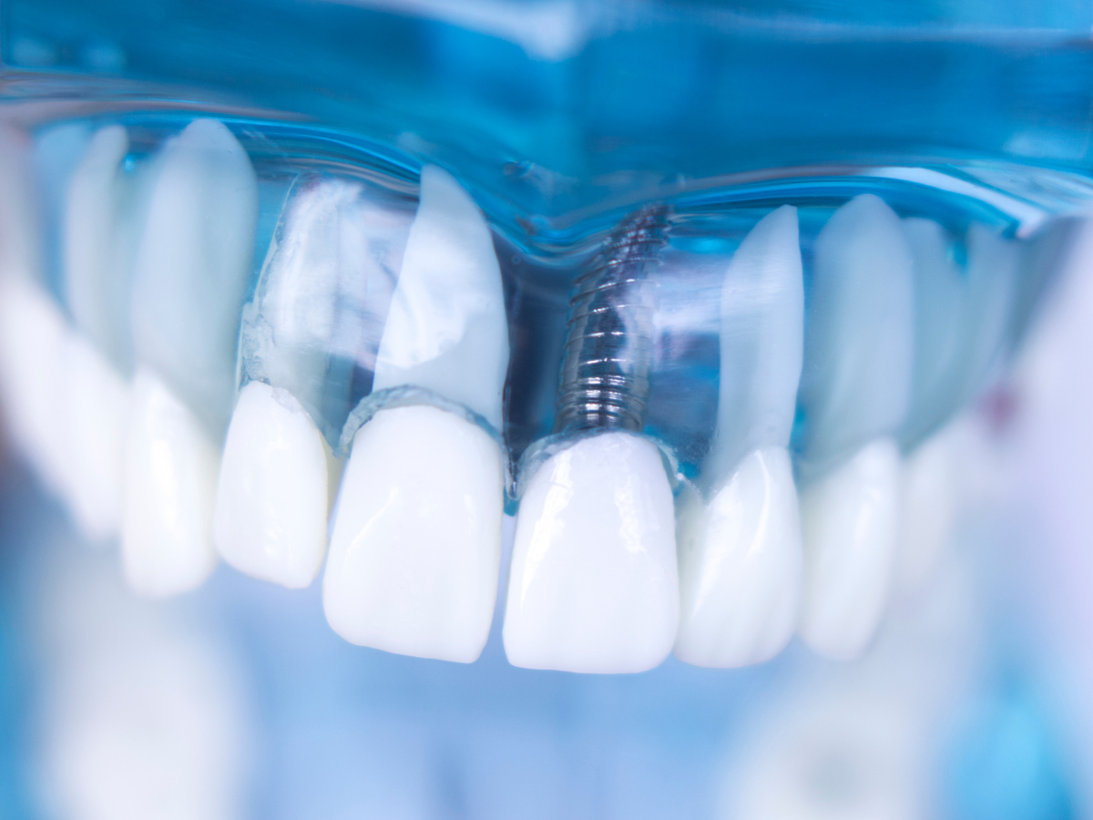 Christiana Pleasant Dental photo 4