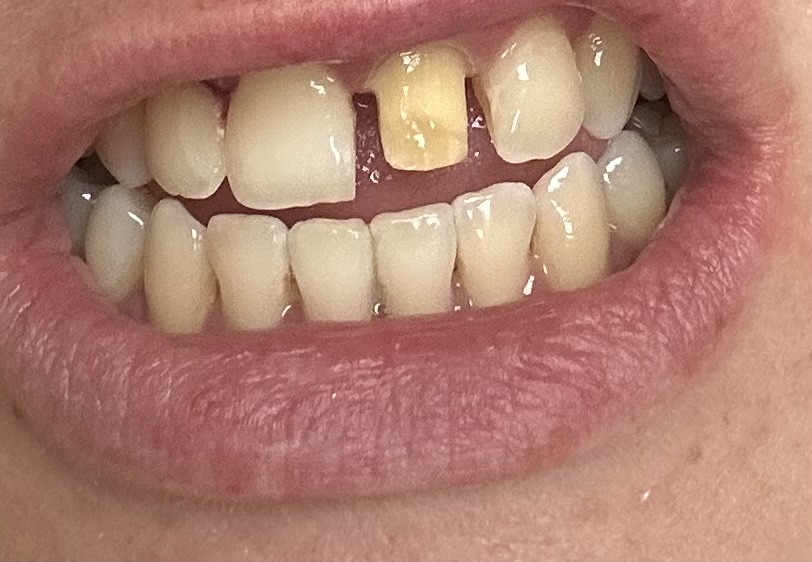 Aspen Dental - Lima photo 4