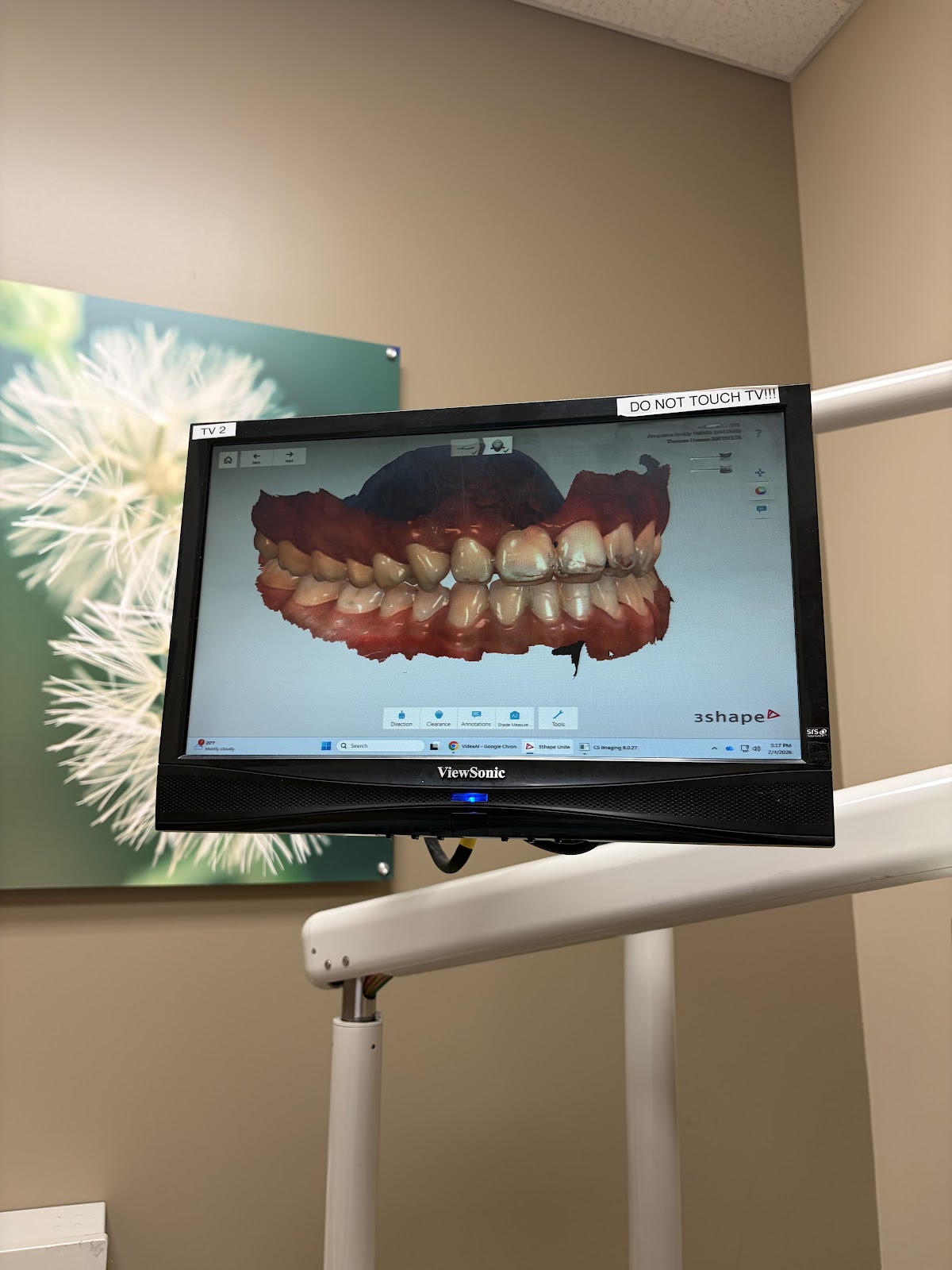 Aspen Dental - Lima photo 5