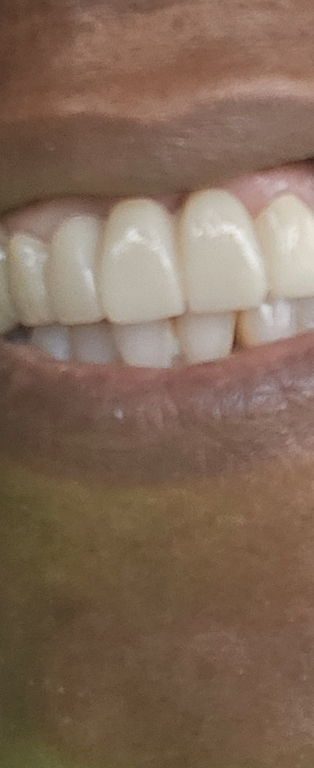 Aspen Dental - Woodbridge photo 4