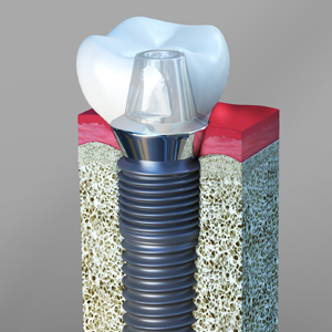 Victoria Place Dental Center photo 1