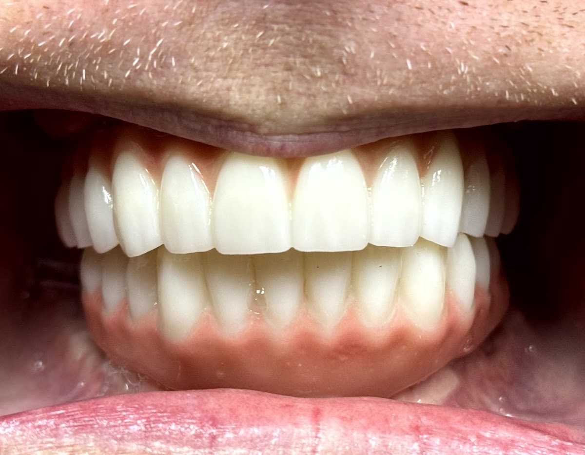Dental, Dentures & Implants - Dr. Nathan Faber photo 3