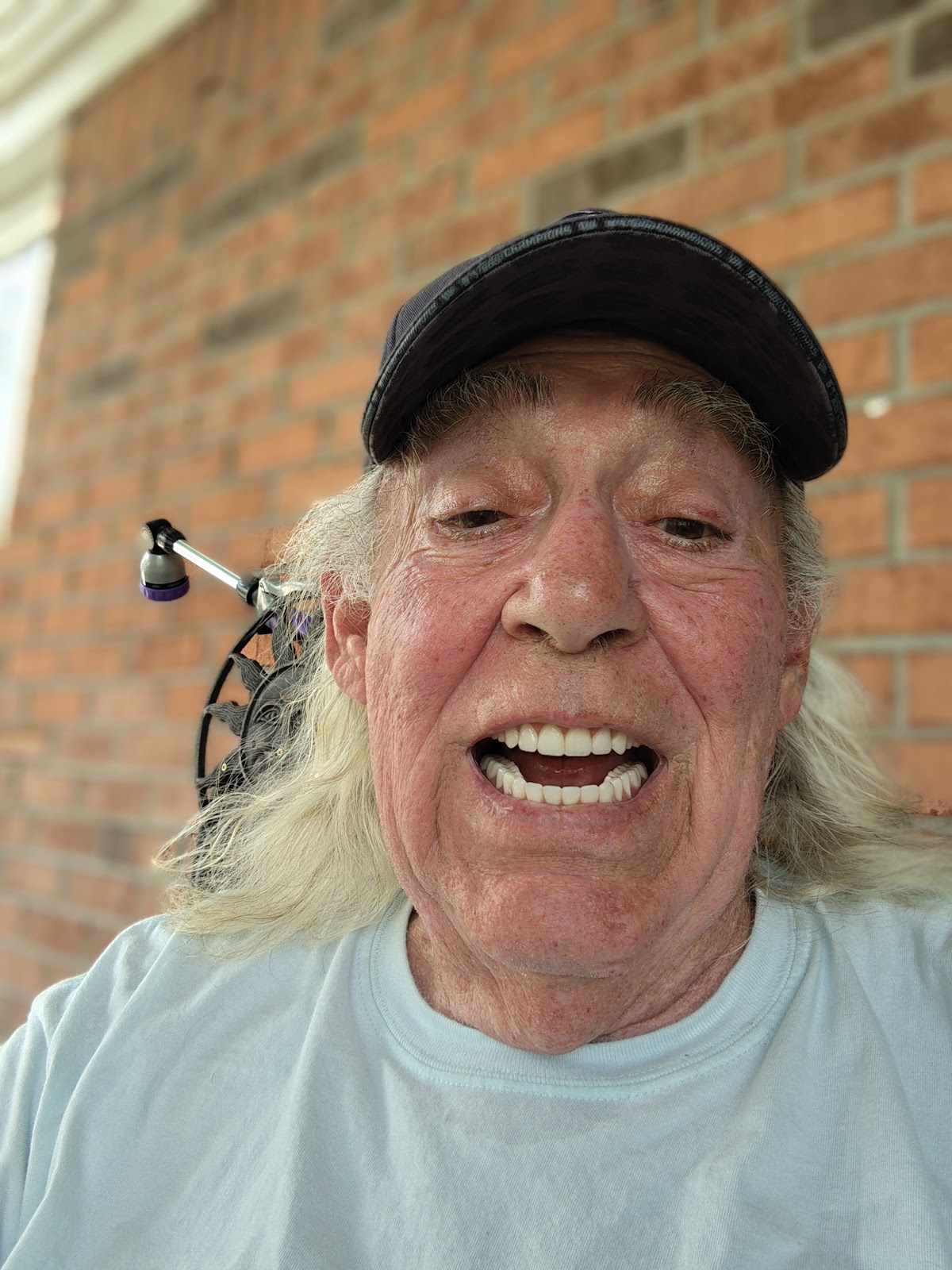 Affordable Dentures & Implants - Fishers photo 5