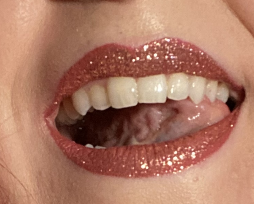 Aspen Dental - Chillicothe photo 3