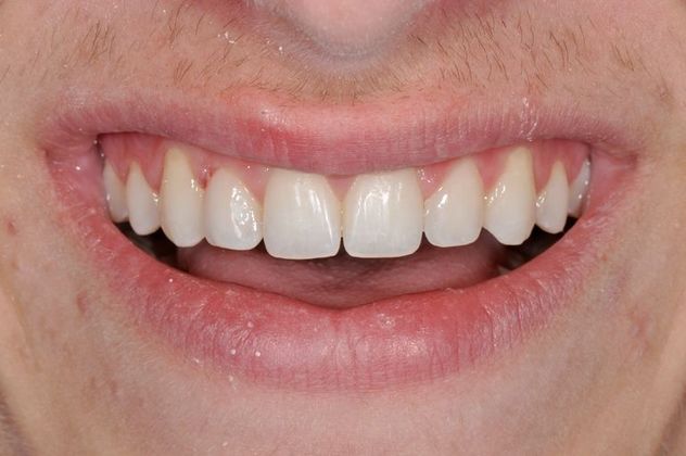 Oak Harbor Family Dentistry photo 2