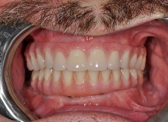 Oak Harbor Family Dentistry photo 5