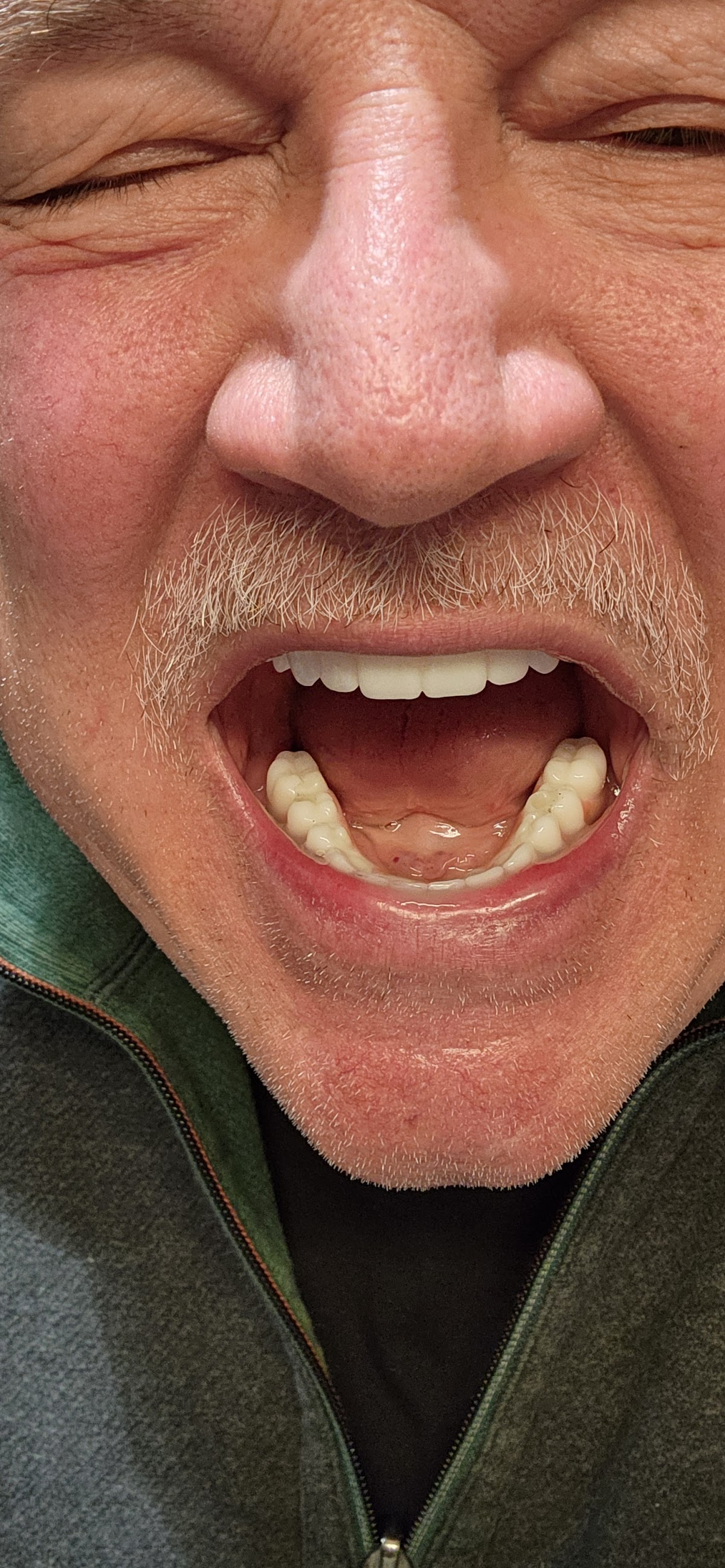 Clearchoice Dental Implant Center - Alexandria photo 3