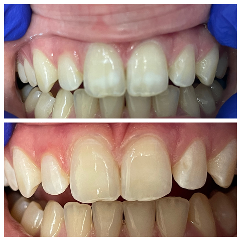 Knight Dental Care - Little Rock photo 4