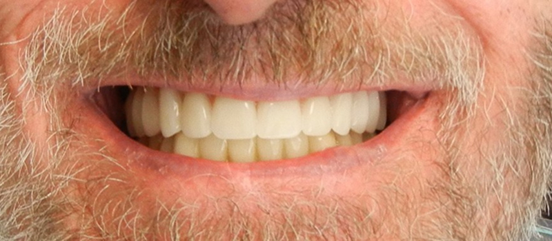 Knight Dental Care - Little Rock photo 6