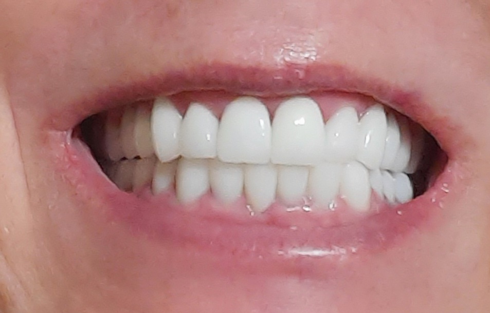 River Valley Smile Center photo 4