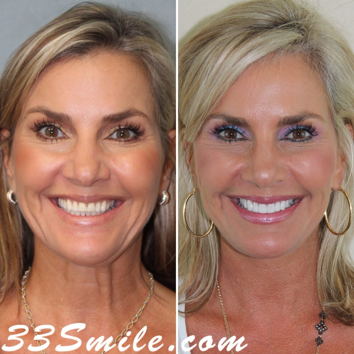 Cosmetic Dental Associates - Medical Center photo 1