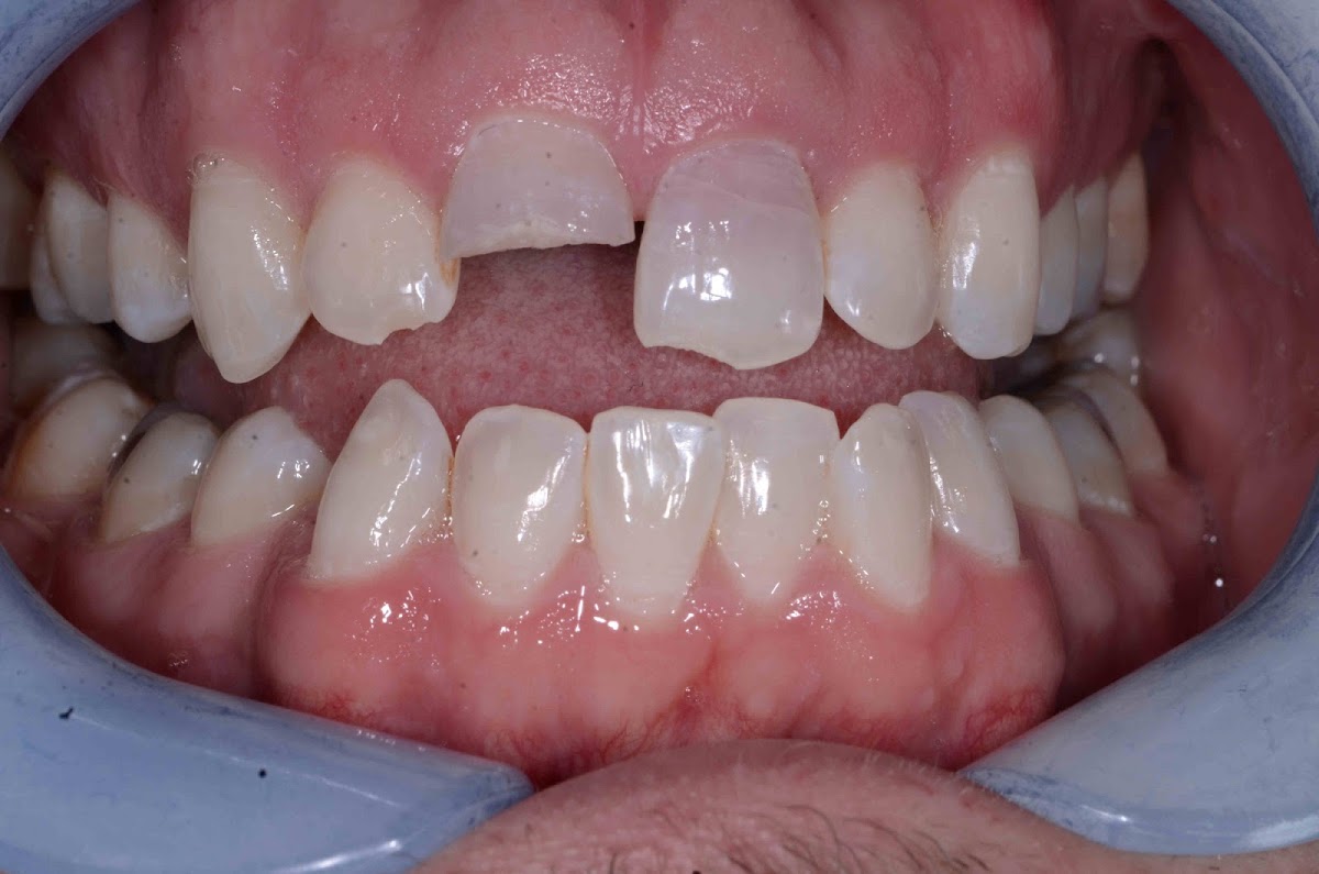 Downtown Dental photo 1