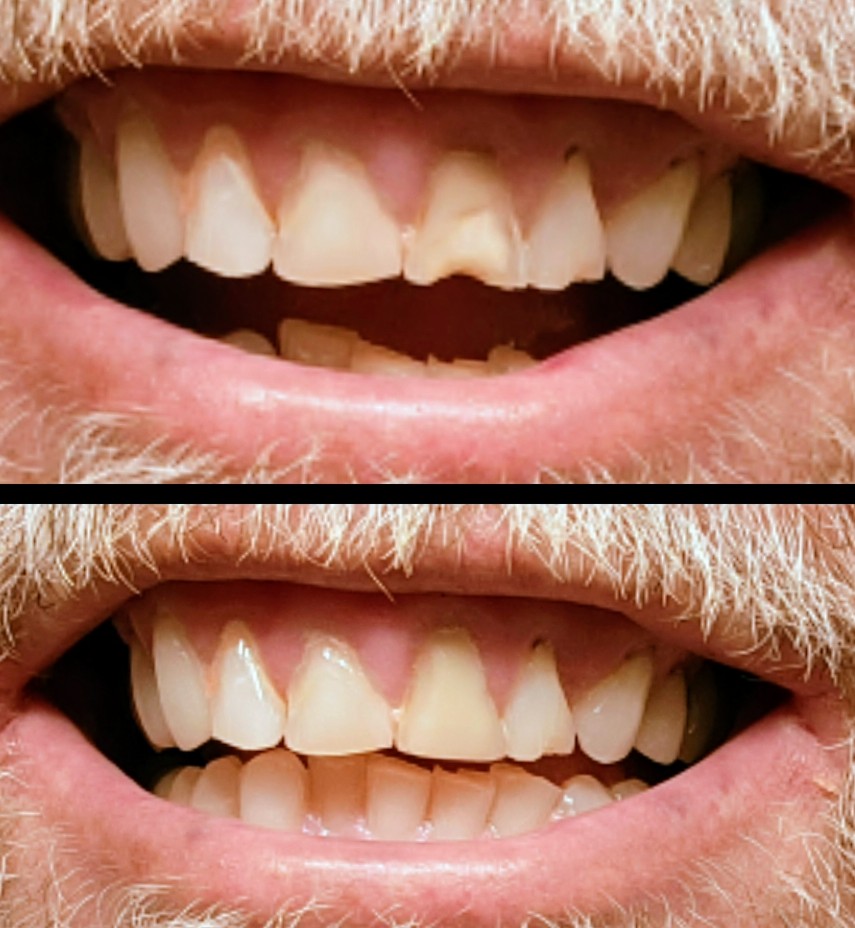 Akhrass Dental Implant & Cosmetic Center photo 3