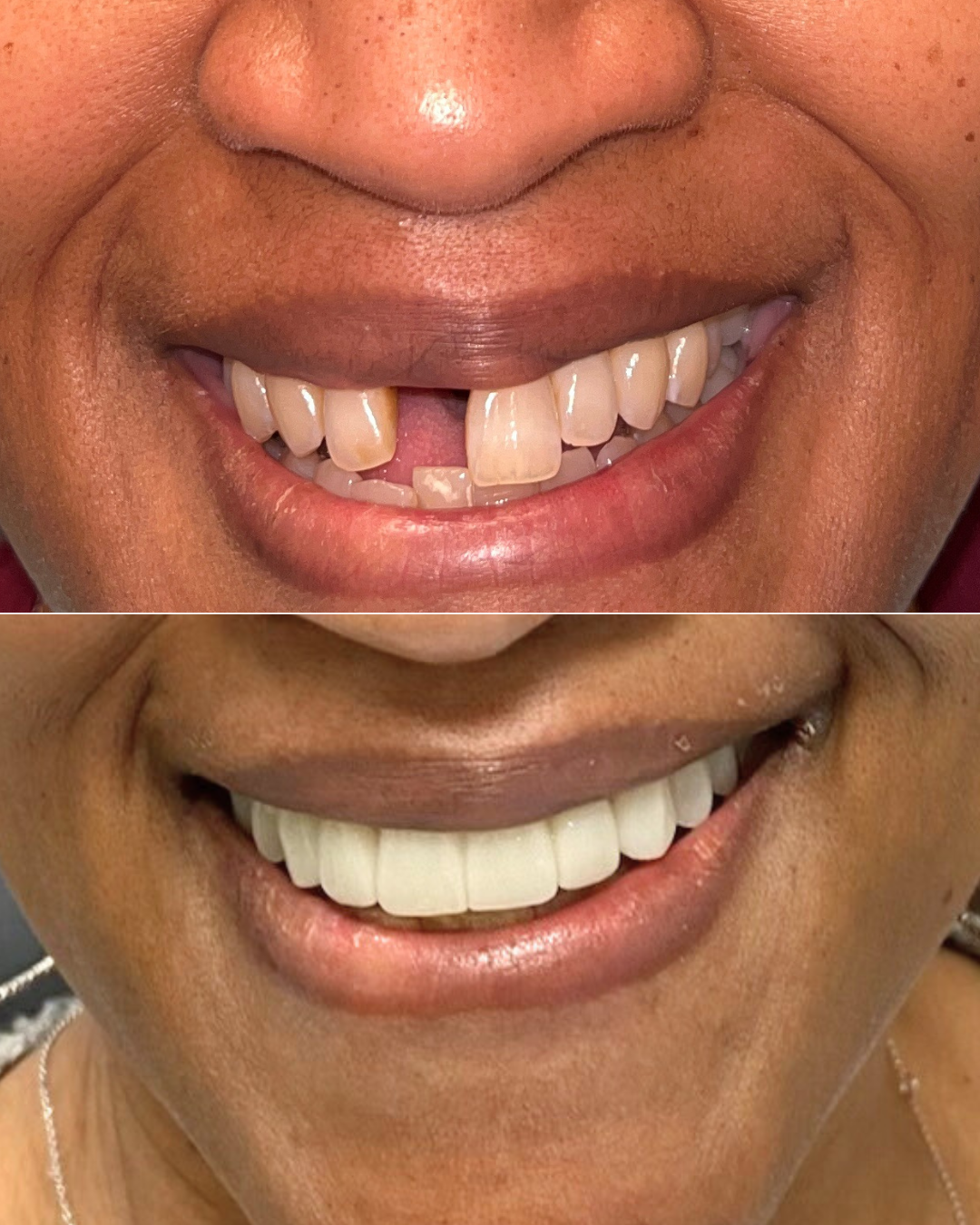 Periodontal Specialists of Vinings photo 1