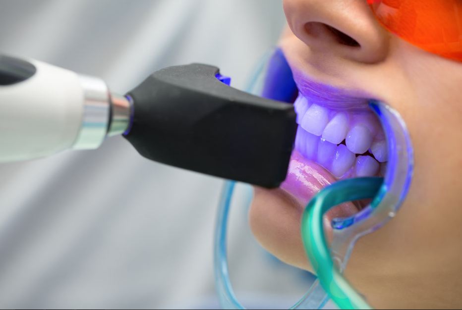 Elite Family Dentistry photo 4