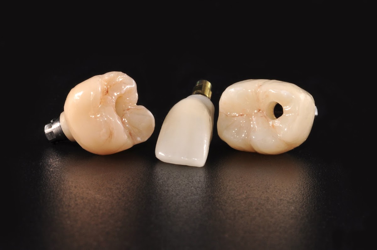 Gie Dental Laboratory photo 4