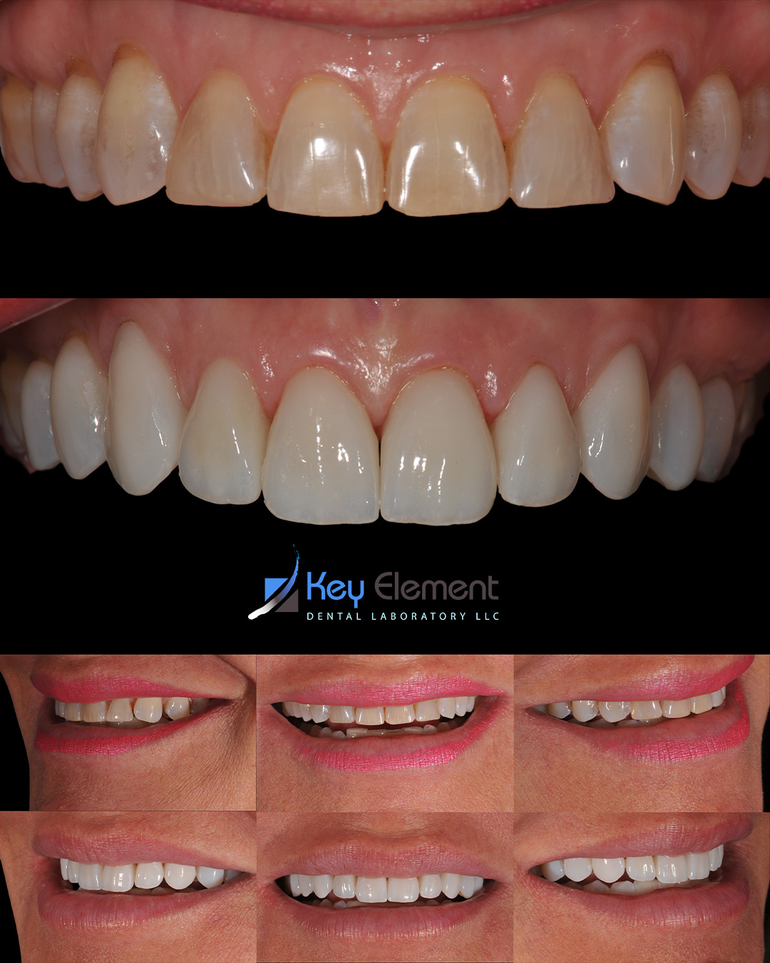 Inter-chrome Dental Lab photo 2