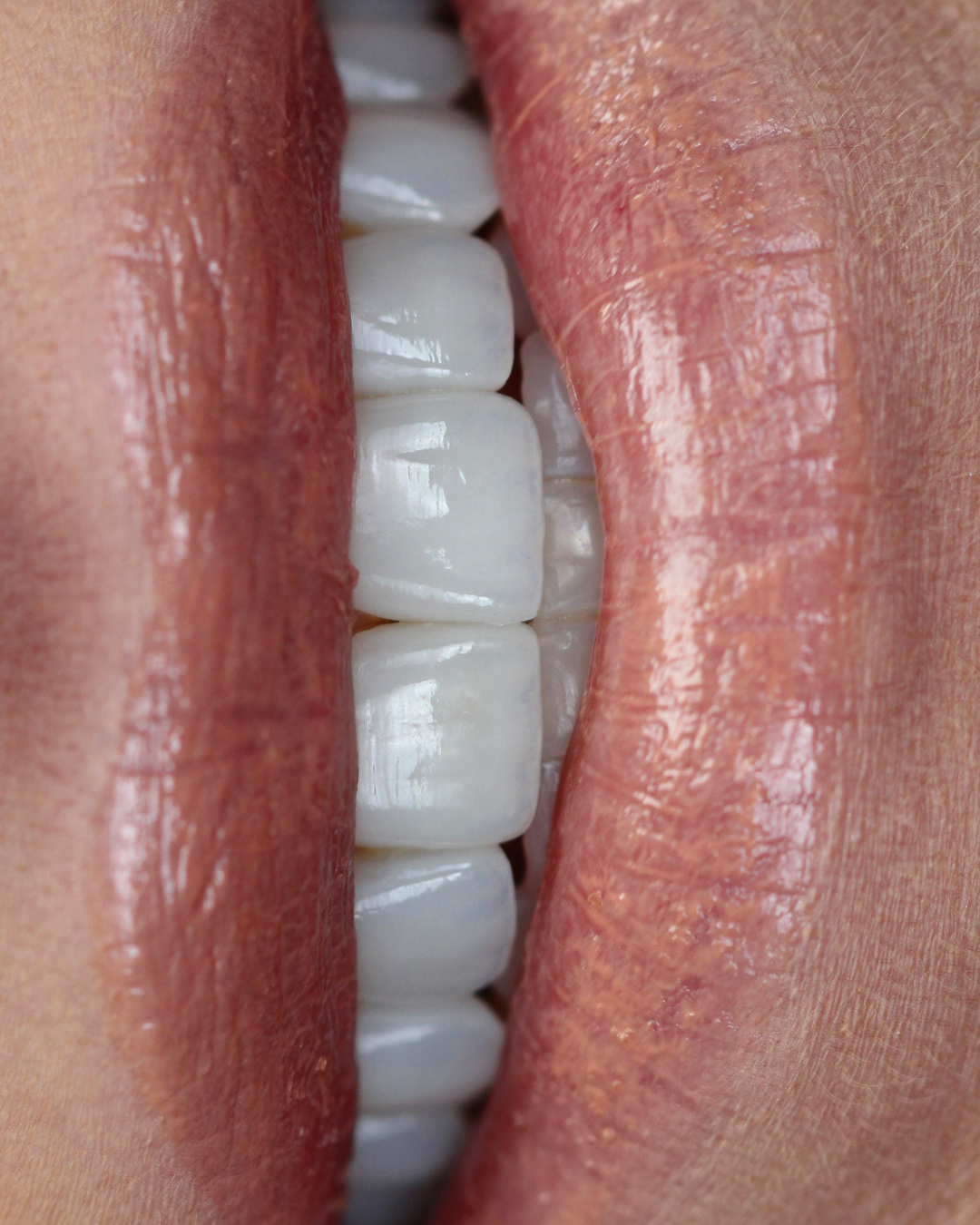 Inter-chrome Dental Lab photo 5