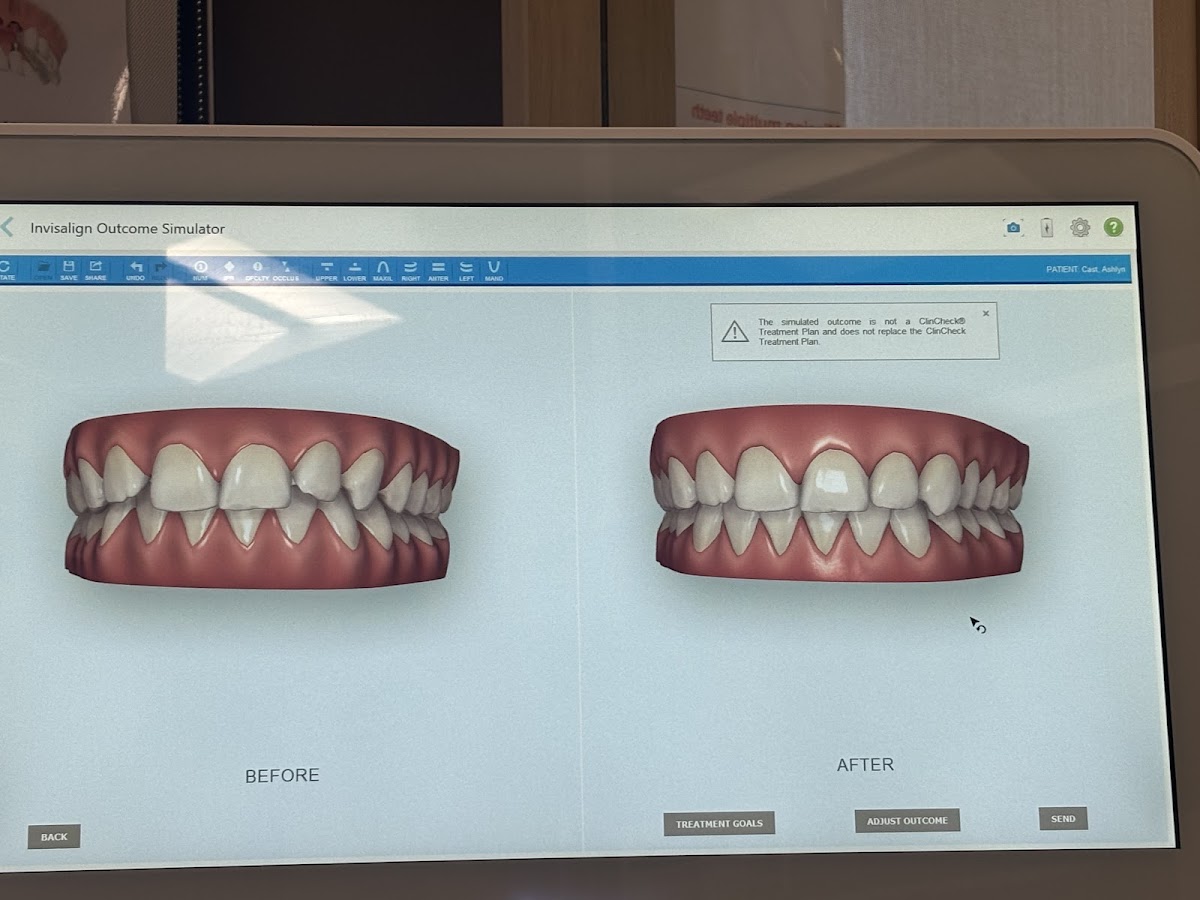 Aspen Dental - Mt Pleasant, Mi photo 2
