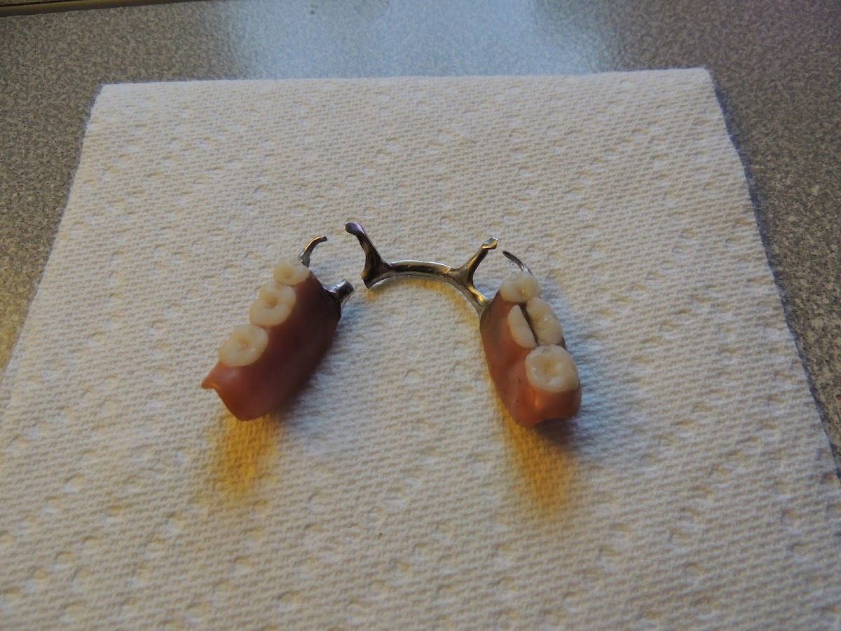 Aspen Dental - Mt Pleasant, Mi photo 6