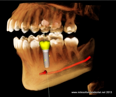 Ct Implant & Oral Surgery photo 4