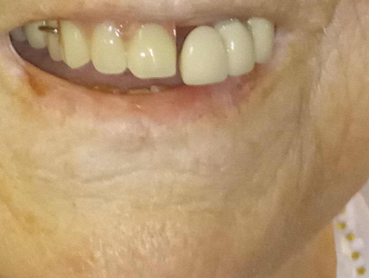 Aspen Dental - Bessemer photo 5