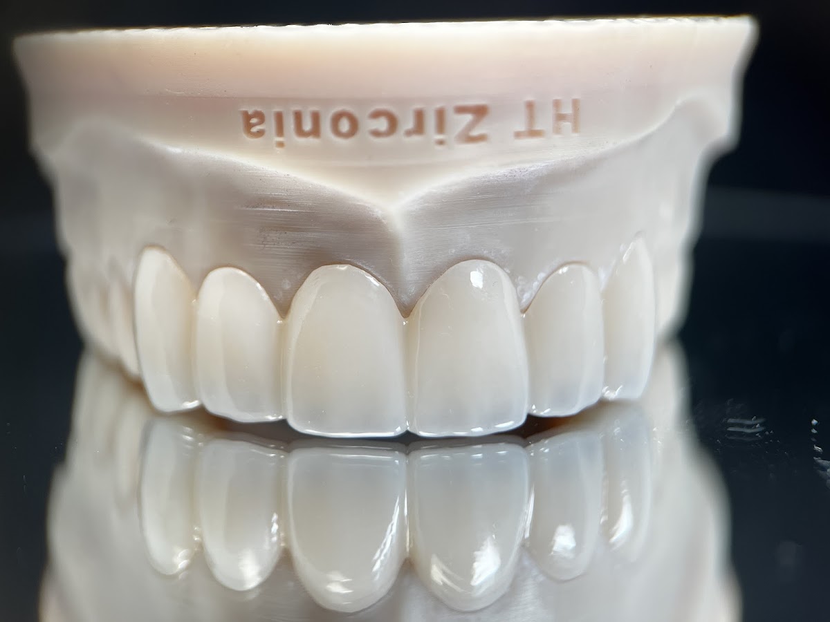 Summit-horizon Dental Lab photo 1