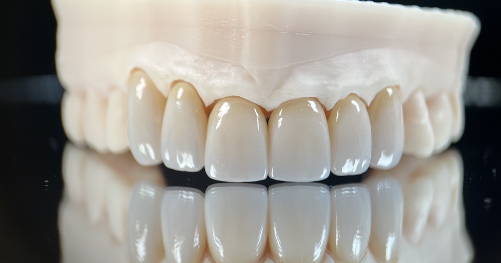 Summit-horizon Dental Lab photo 3
