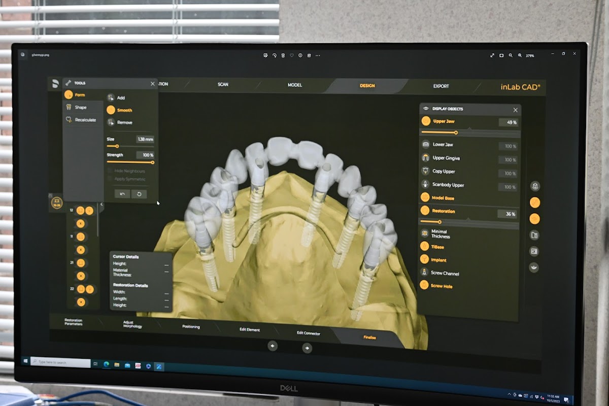 Summit-horizon Dental Lab photo 6