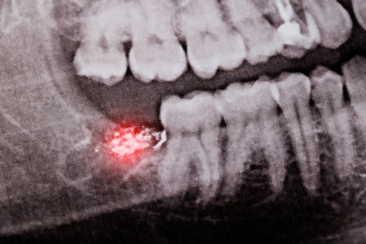 Sun City Oral Surgery & Implant Center photo 5