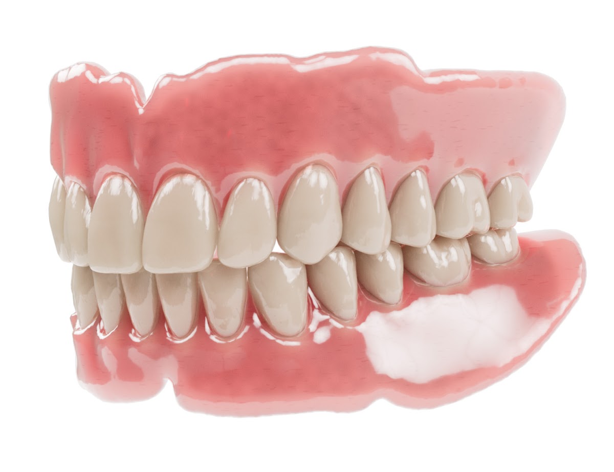 Renew Smiles Dental Implant Center – Deland photo 3