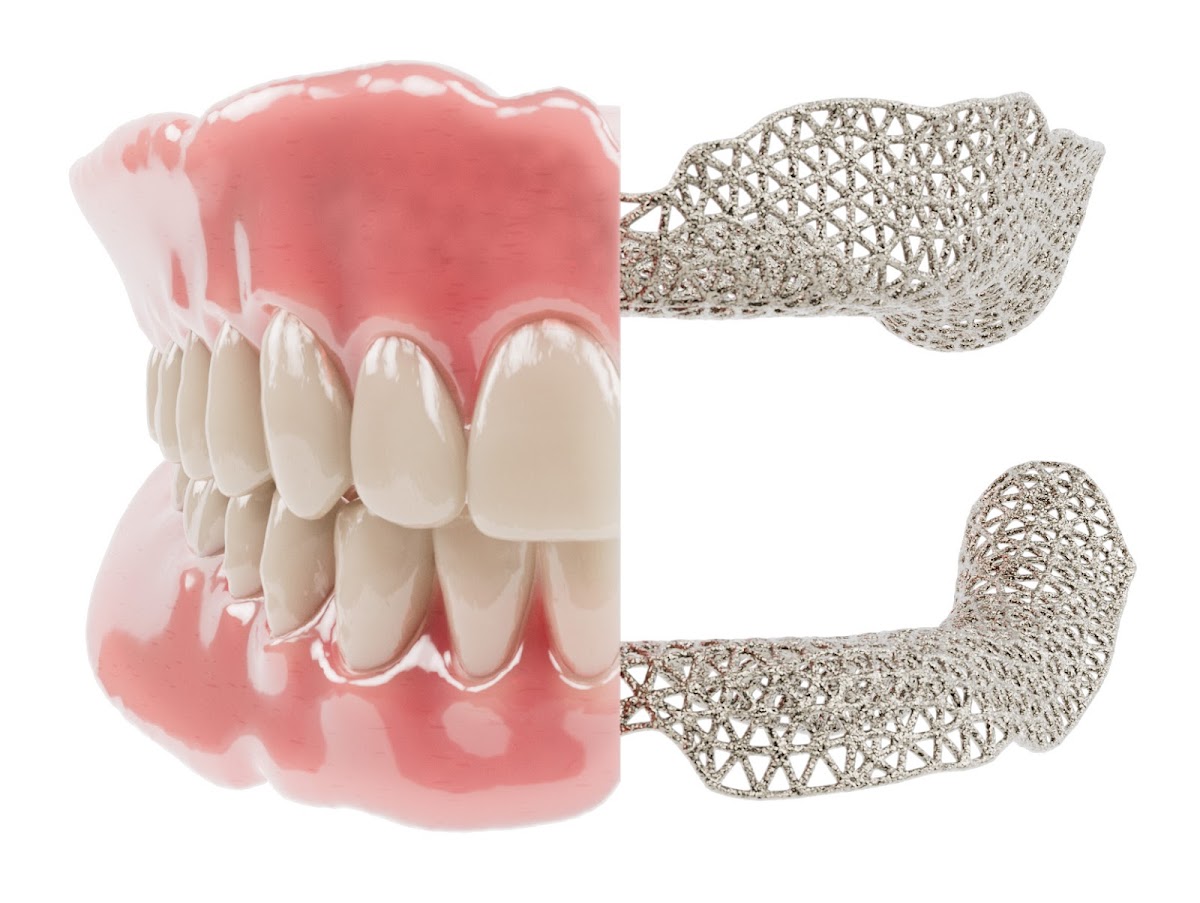 Renew Smiles Dental Implant Center – Deland photo 4