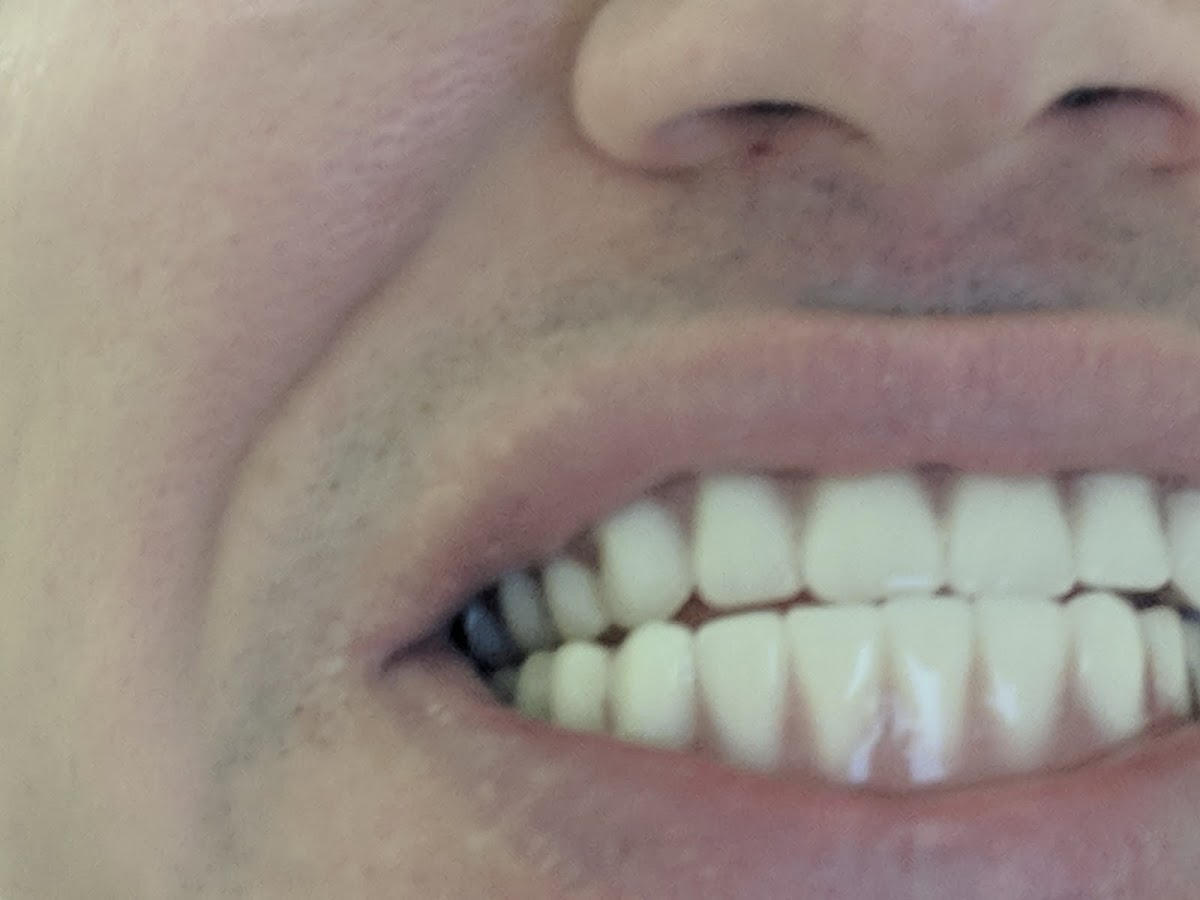 Aspen Dental - Mattoon photo 2