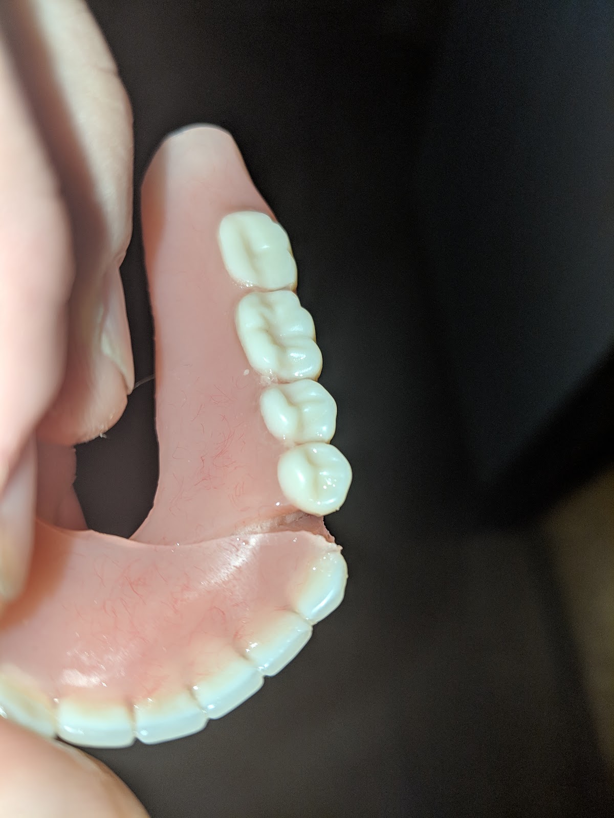 Aspen Dental - Mattoon photo 5