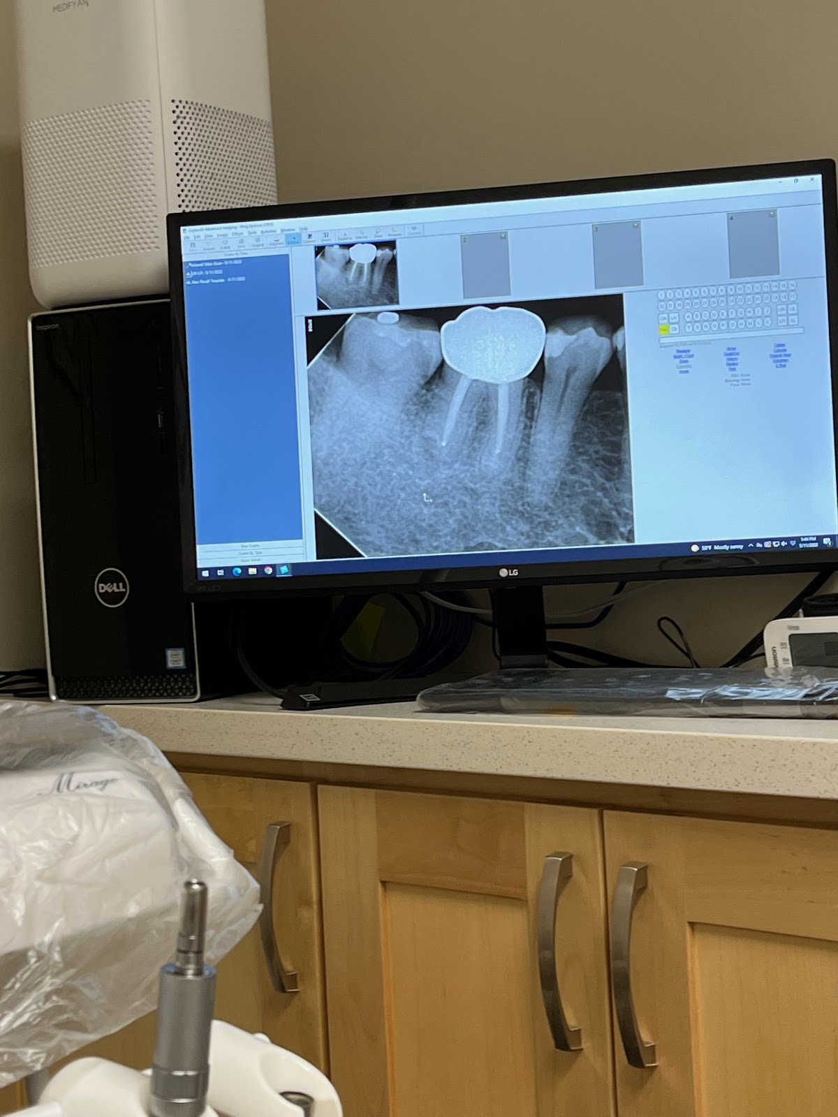 Fresh Smiles Family & Cosmetic Dentistry photo 6