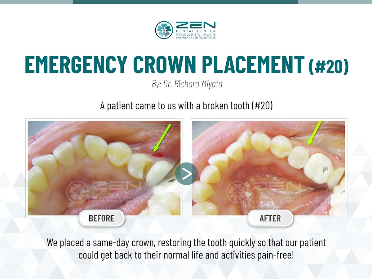 Zen Dental Center Family Cosmetic Emergency Implants photo 2