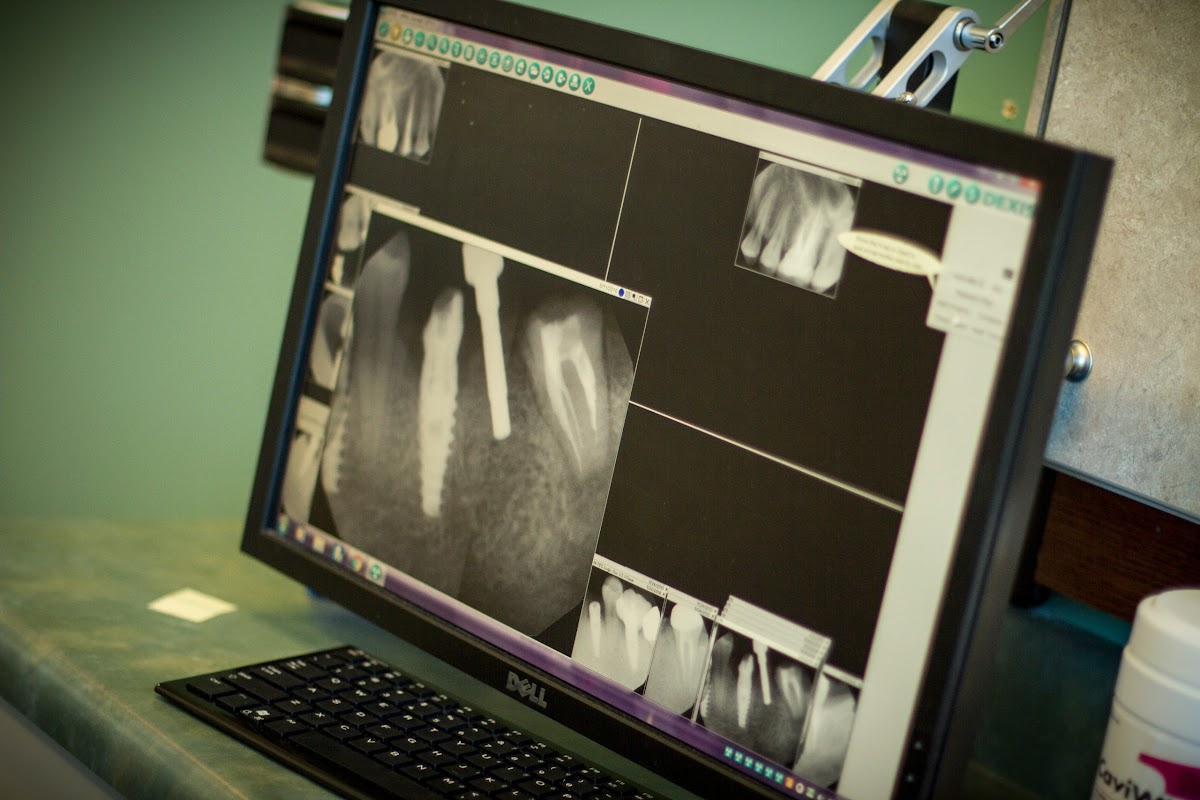 Utah Smile Clinic photo 5