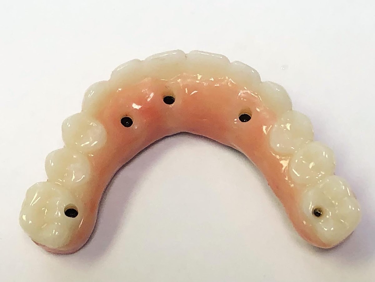 Implant Center of the Palm Beaches "full Mouth Implants" - Jack T. Krauser, DMD photo 4