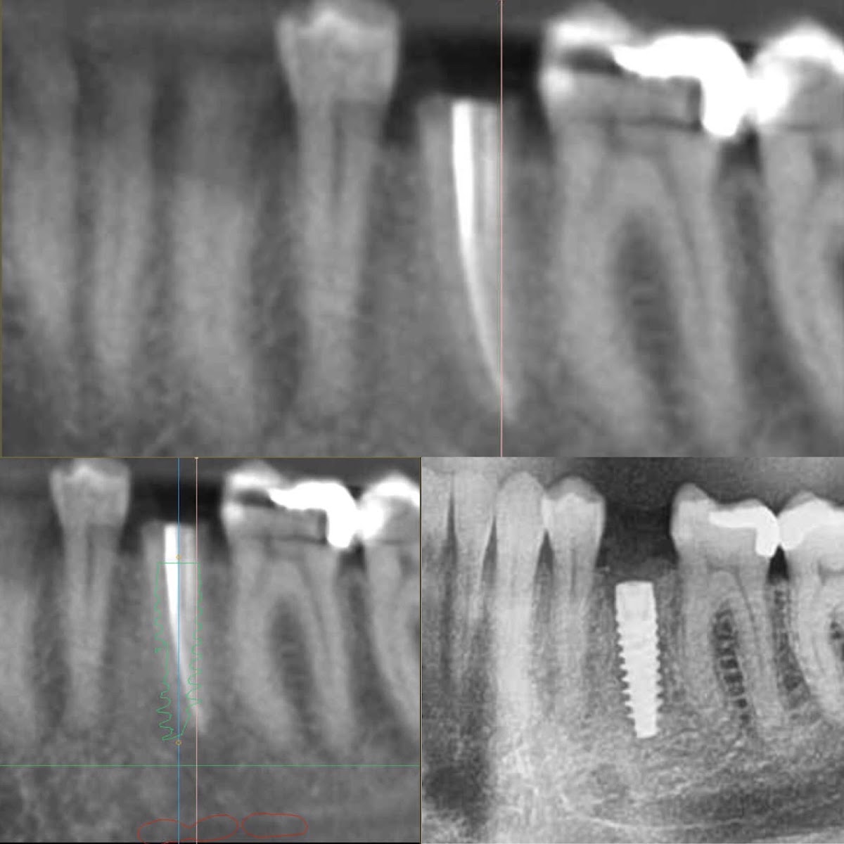 Torrance Oral Surgery Center photo 2
